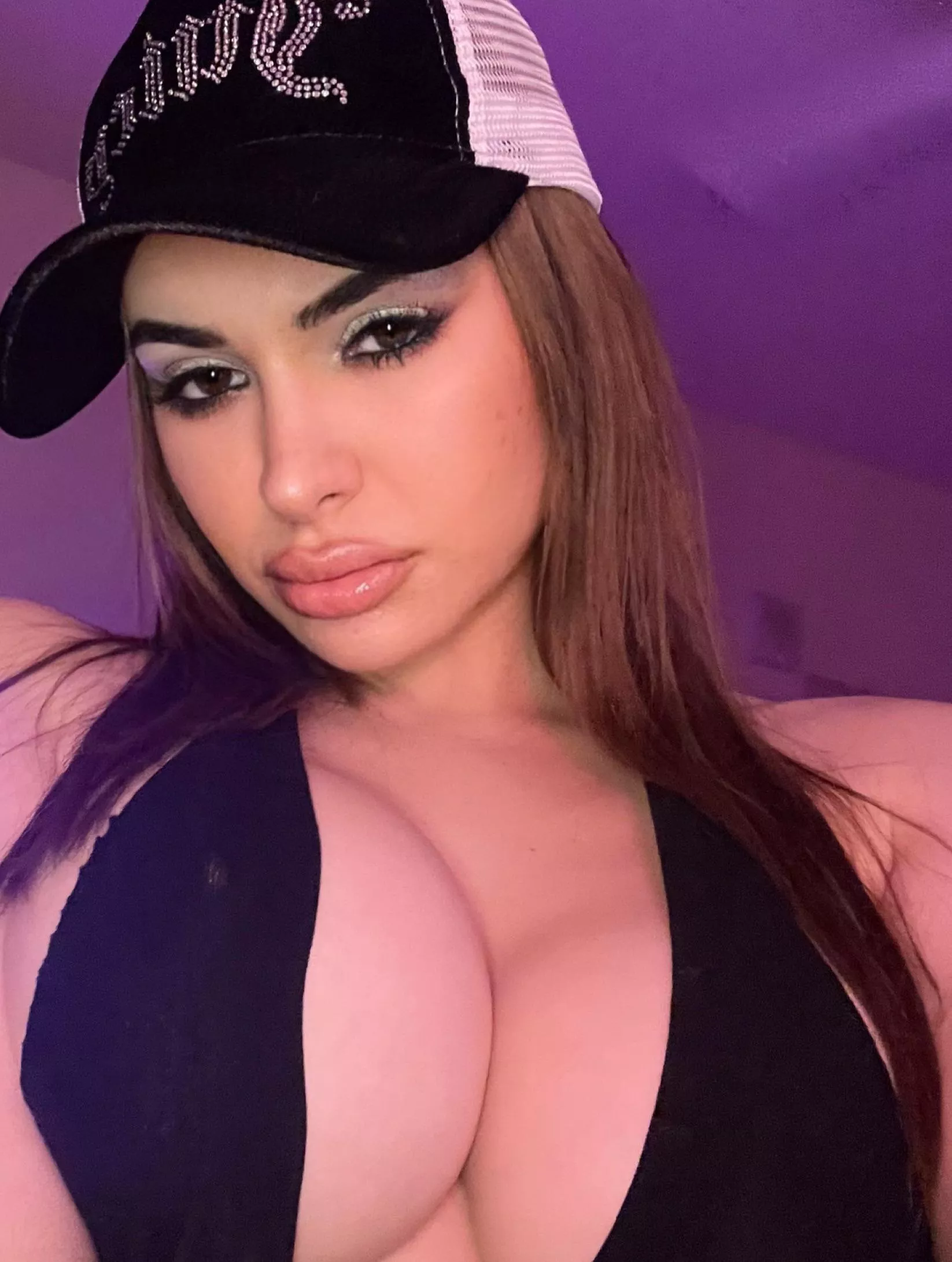 I got my lips done! And i’m already wanting another syringe!!!! posted by bimbomeplease