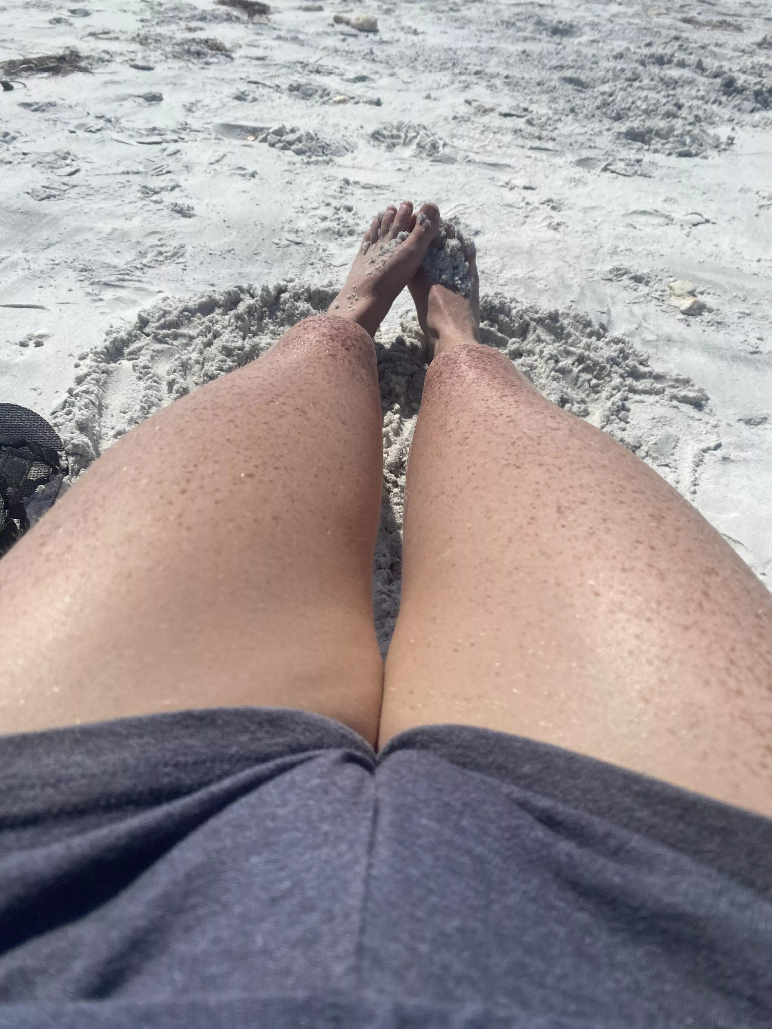 Should I pull them up higher? posted by Nervous_Wrongdoer_82