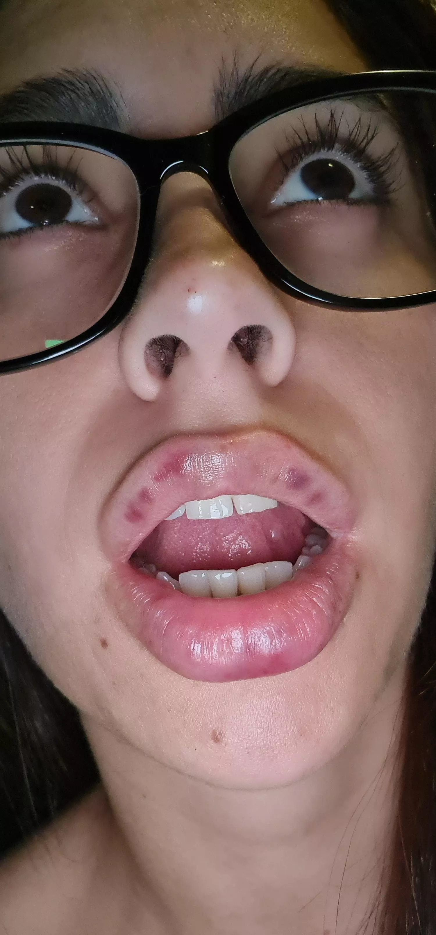 What happened there? 🥺 posted by West_Fox_Arg