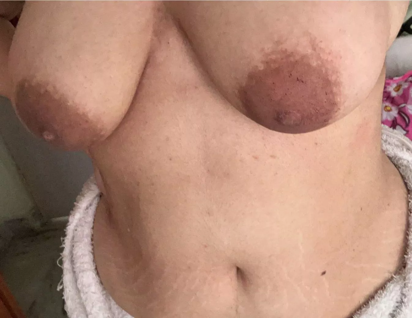 Aftermath of a bristled hairbrush. posted by givemethed1290