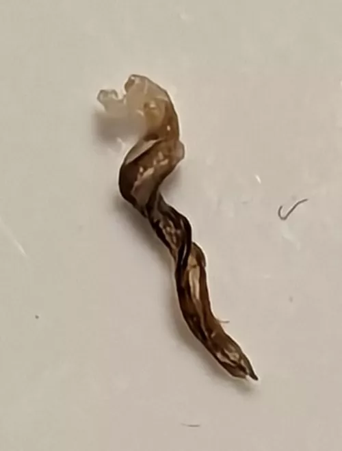 My wife pulled this little bugger out from my beard. Seems to be two ingrown hairs intertwined with each other by MildMastermind
