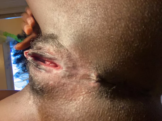 You want to know how tight it is by perfectiris