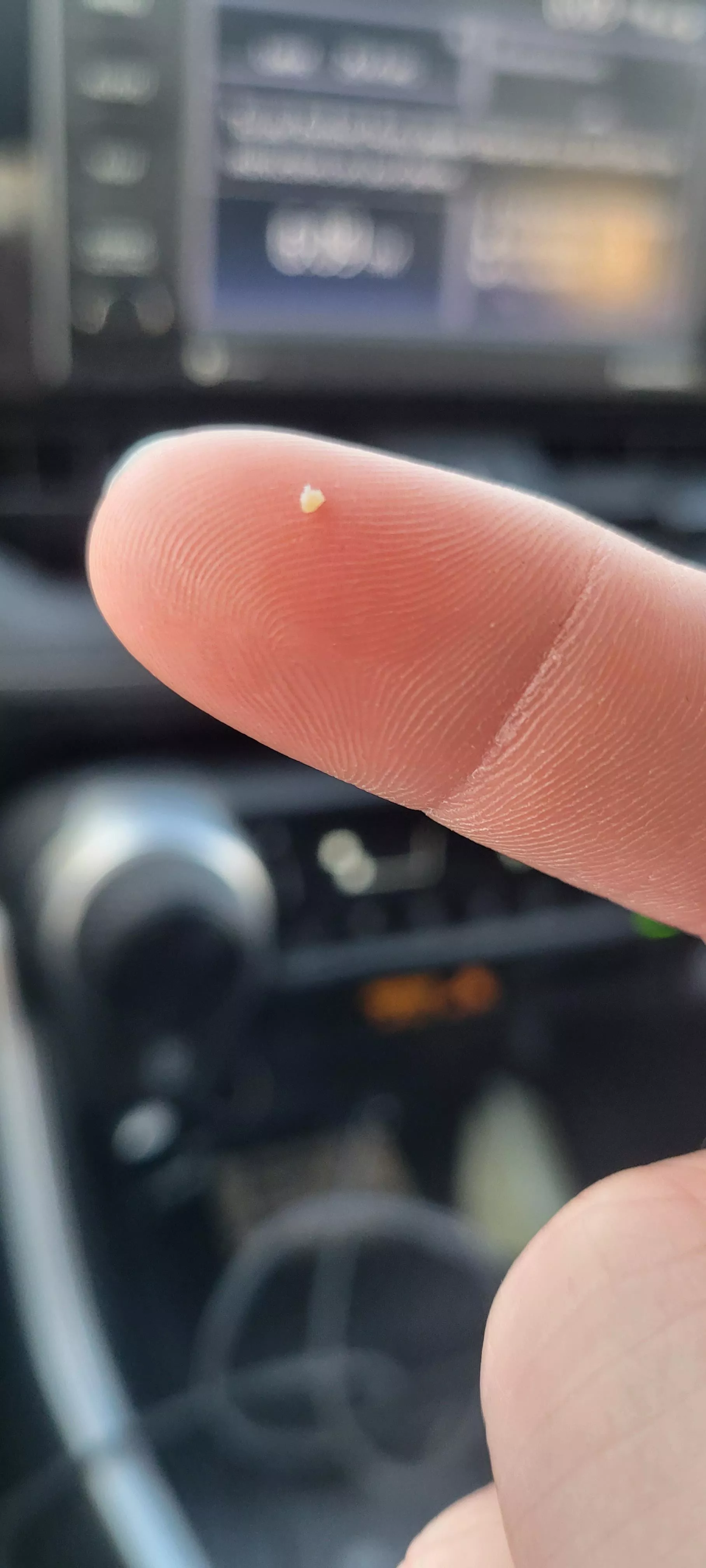 I get a milia-on of these on my face, since I have psoriasis. Annoys me but they're very satisfying to extract! posted by Saratoninn5