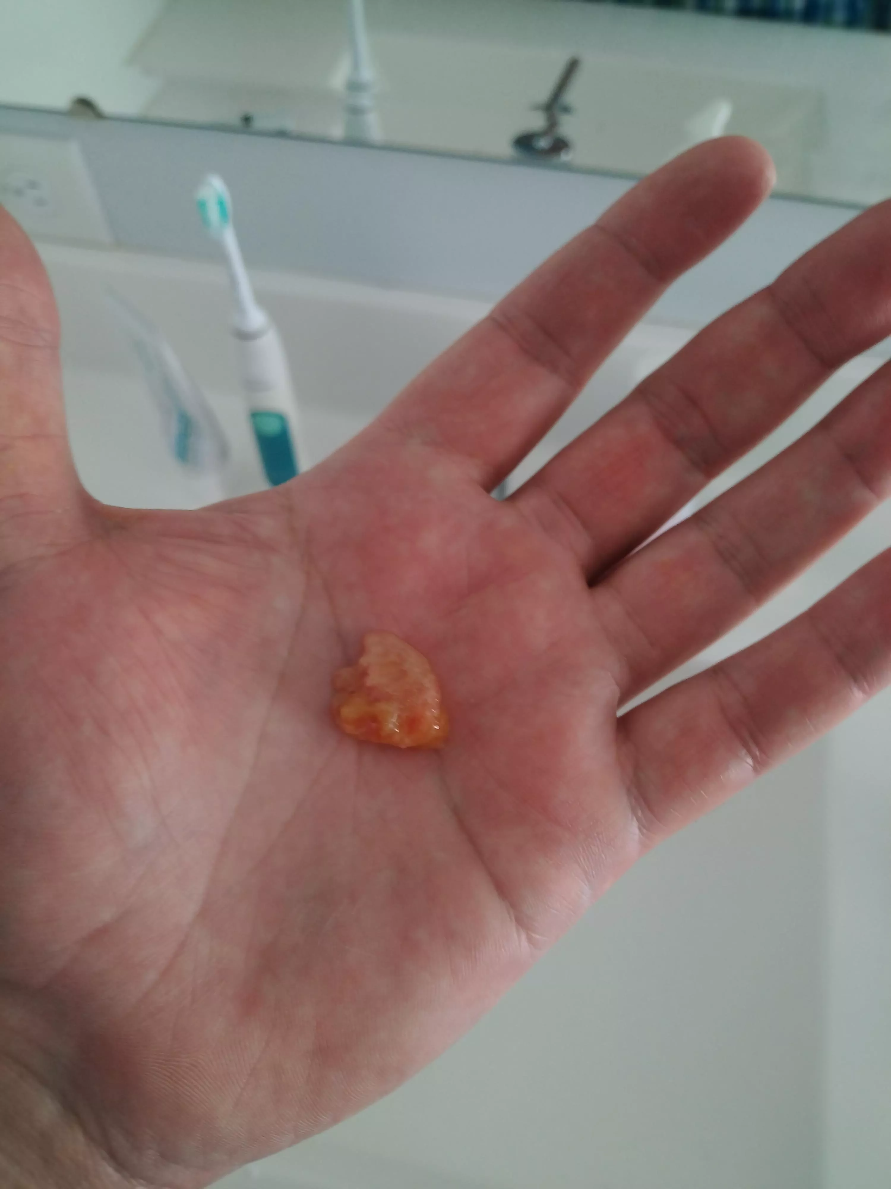 Sinus infection for 2 weeks. Instant relief! posted by gertgertgertgertgert