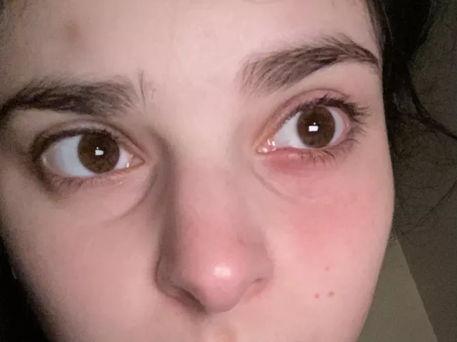 Some time and some hot compresses later. I am in hell by throwaway_ouchmetoe