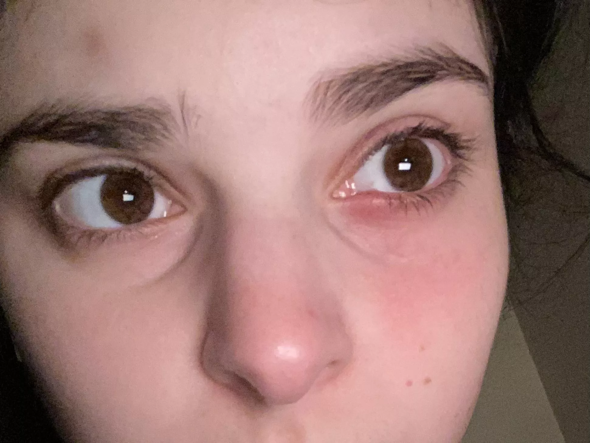 Some time and some hot compresses later. I am in hell posted by throwaway_ouchmetoe