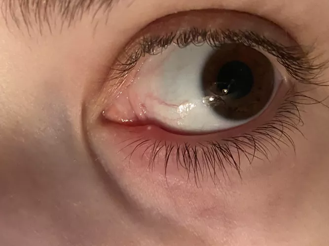 This sucker is killing me. by throwaway_ouchmetoe