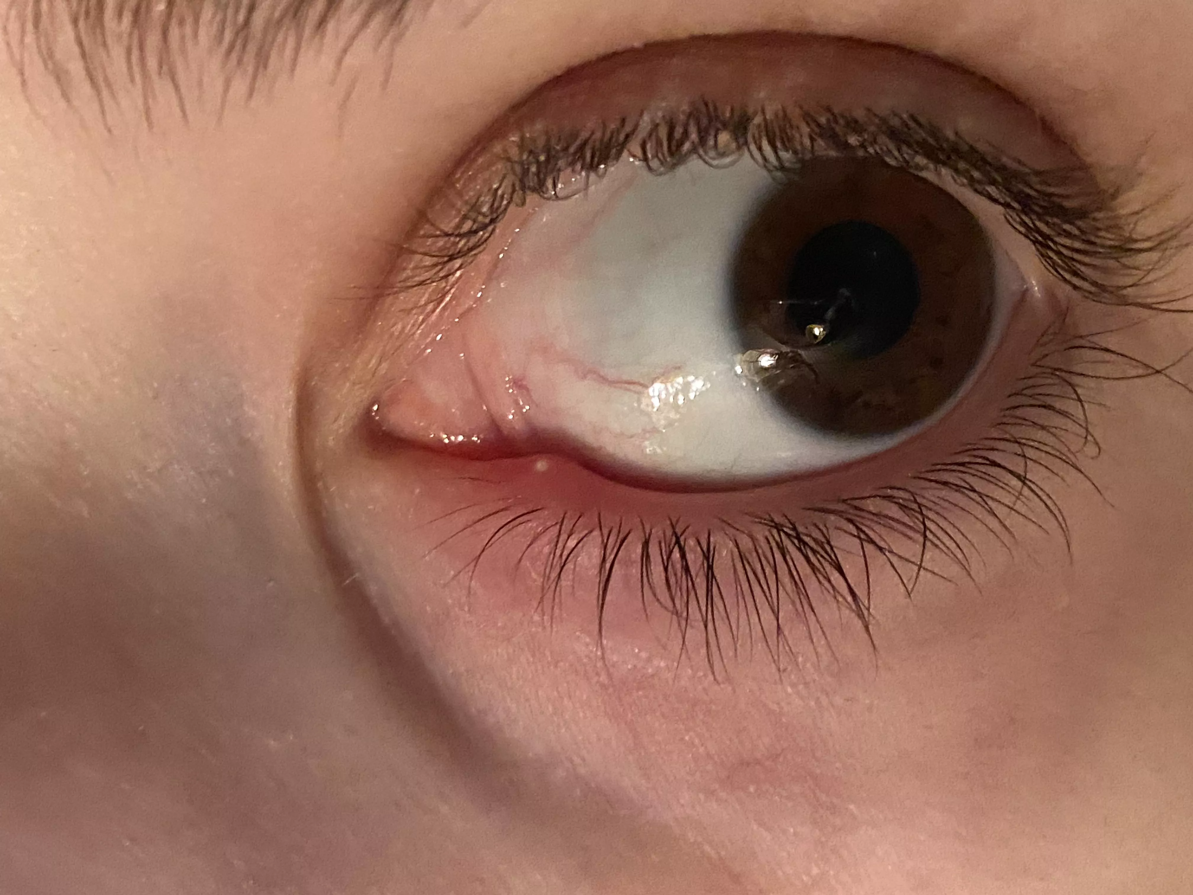 This sucker is killing me. posted by throwaway_ouchmetoe