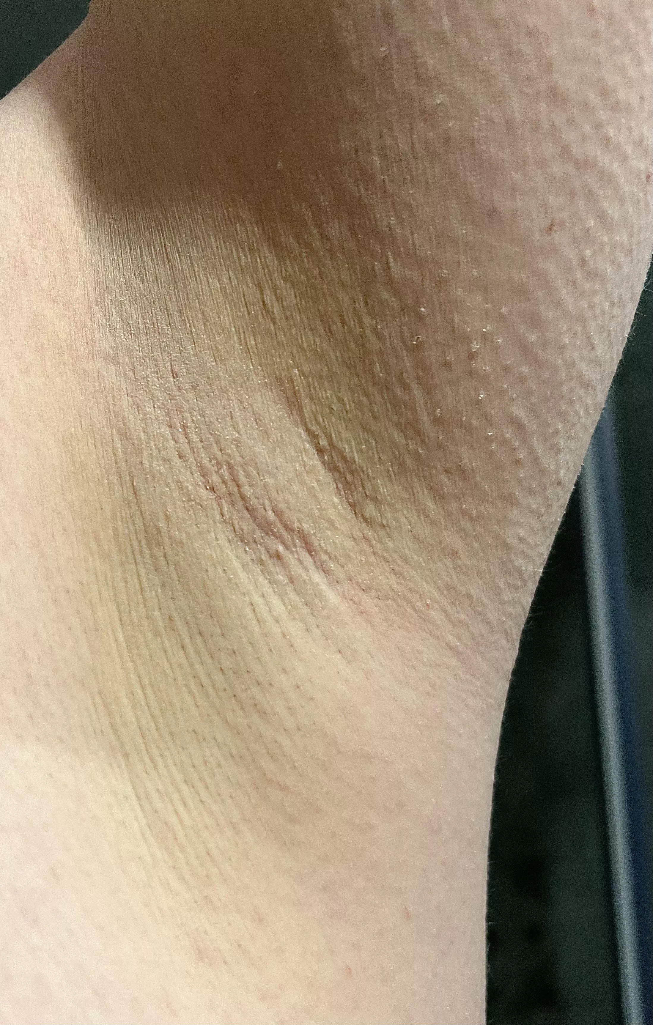 I’m back, did you miss me? posted by sunnypits