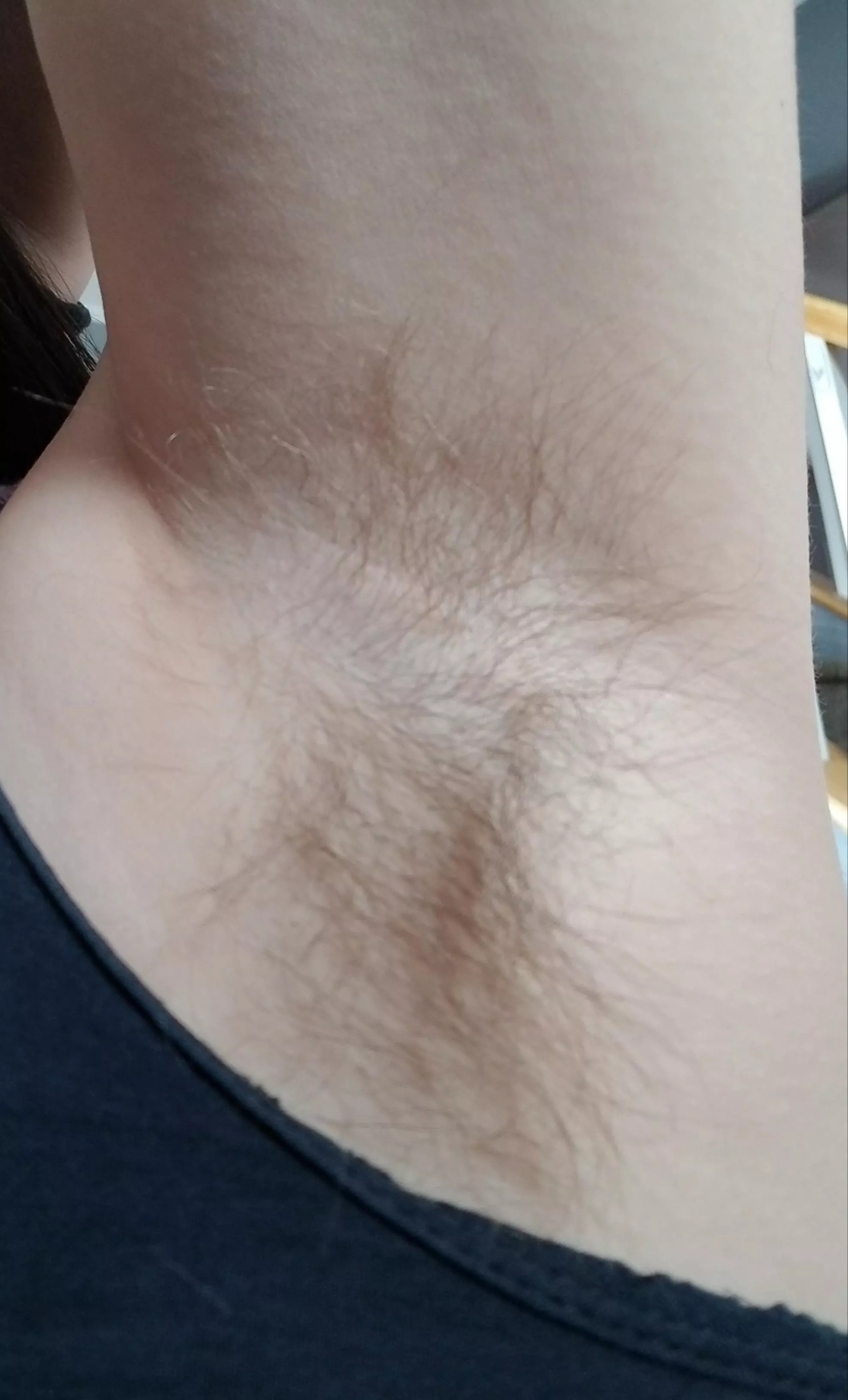 Over 6 months of growth. Everywhere else is hairy too 😏 posted by ZoraMaySilver