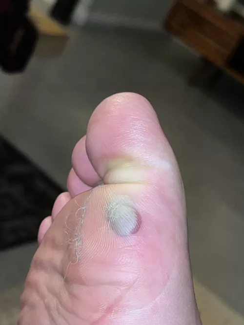 The urge to pop it is overwhelming by wraplan