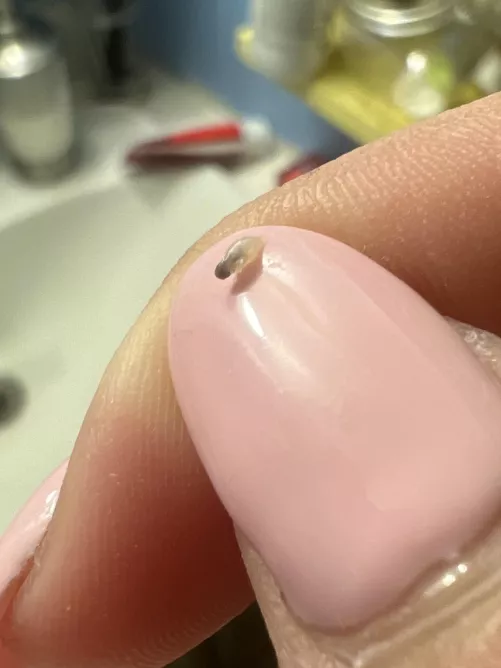 This came from a painful pimple in my butt crack. I only wish I was able to see it come out by I_am_also_a_Walrus