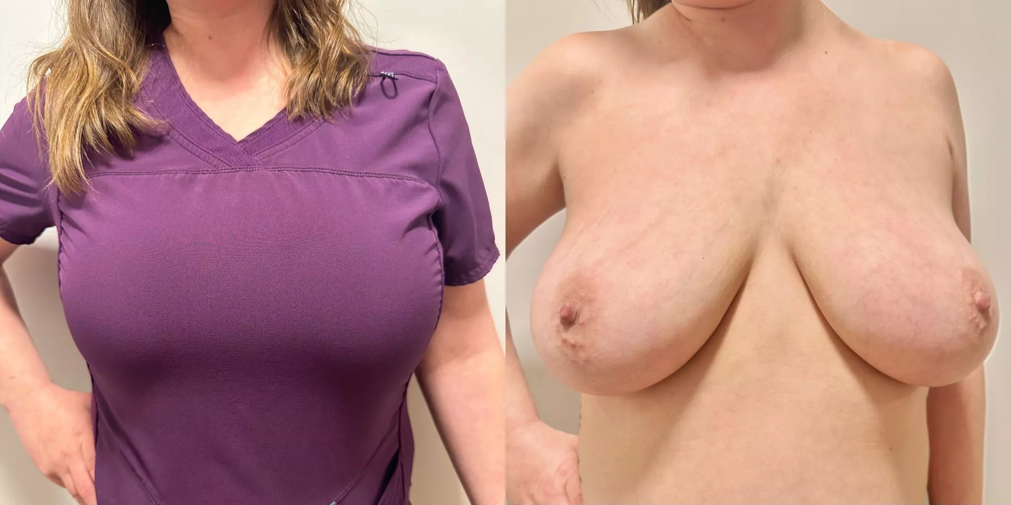 Can I titty fuck you during an exam?😊 posted by PassIll2838