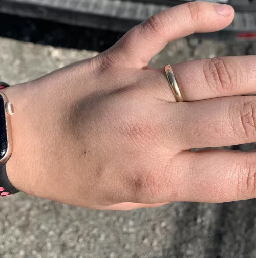 Forbidden pop, hand got caught between a drill and a pole then this suddenly appeared by Sad-And-Mad