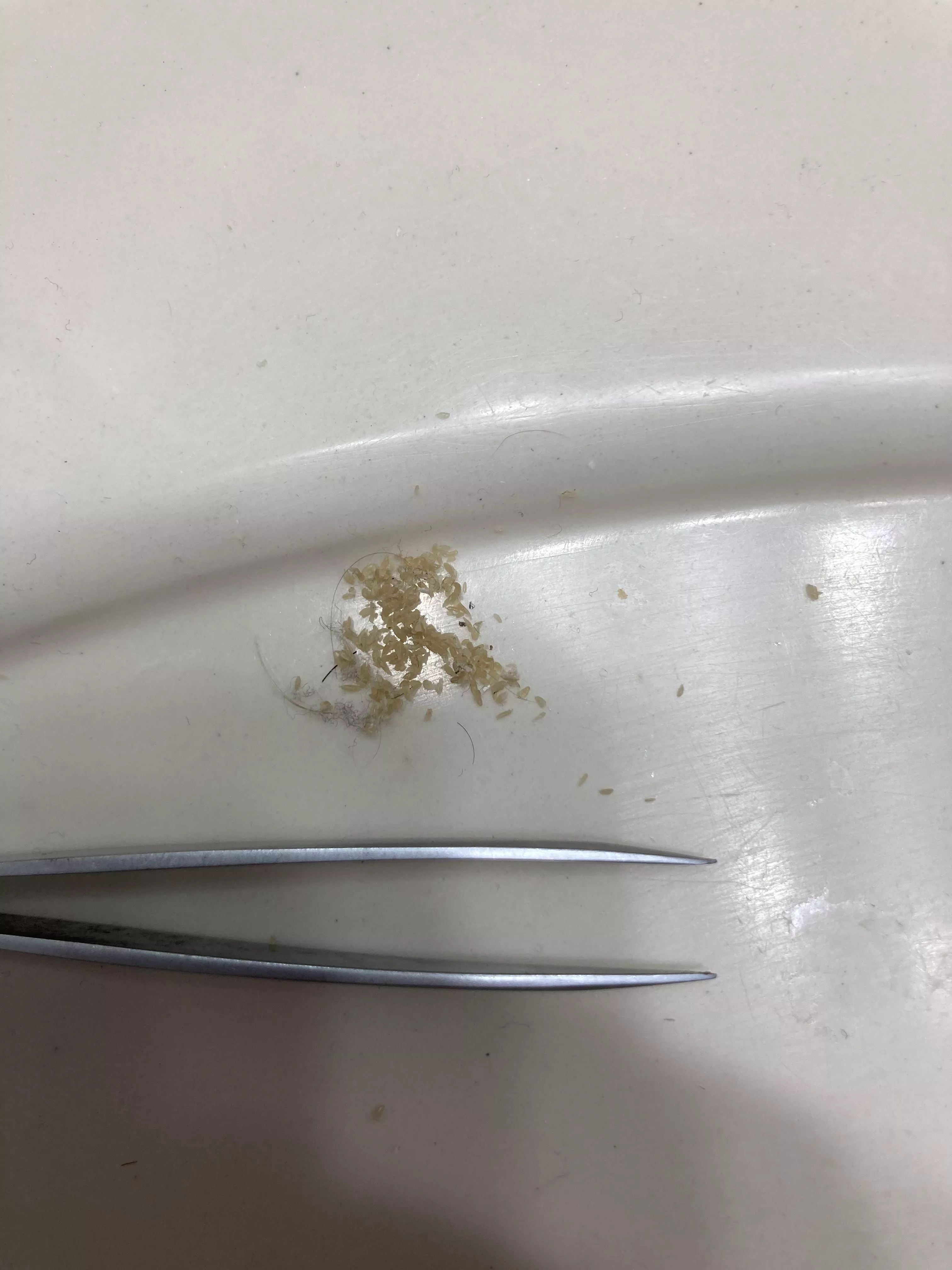 I don’t know what else to do with this picture. All of the blackheads I squeezed out of my nose in about 2 hours. posted by Longjumping-Dot-4824