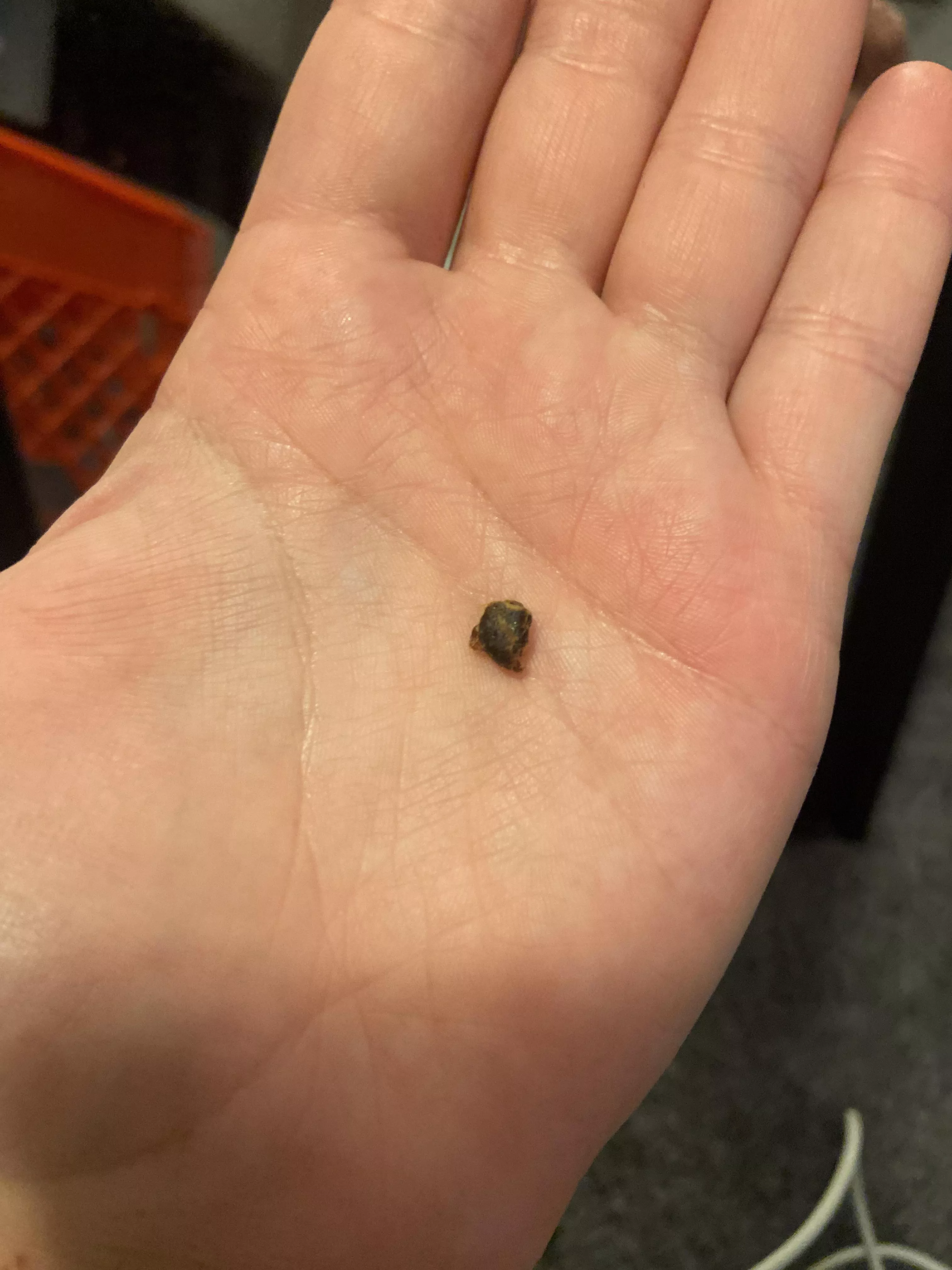 From my ear.. huge clump of wax falls out every once in a while. posted by pickledumbass