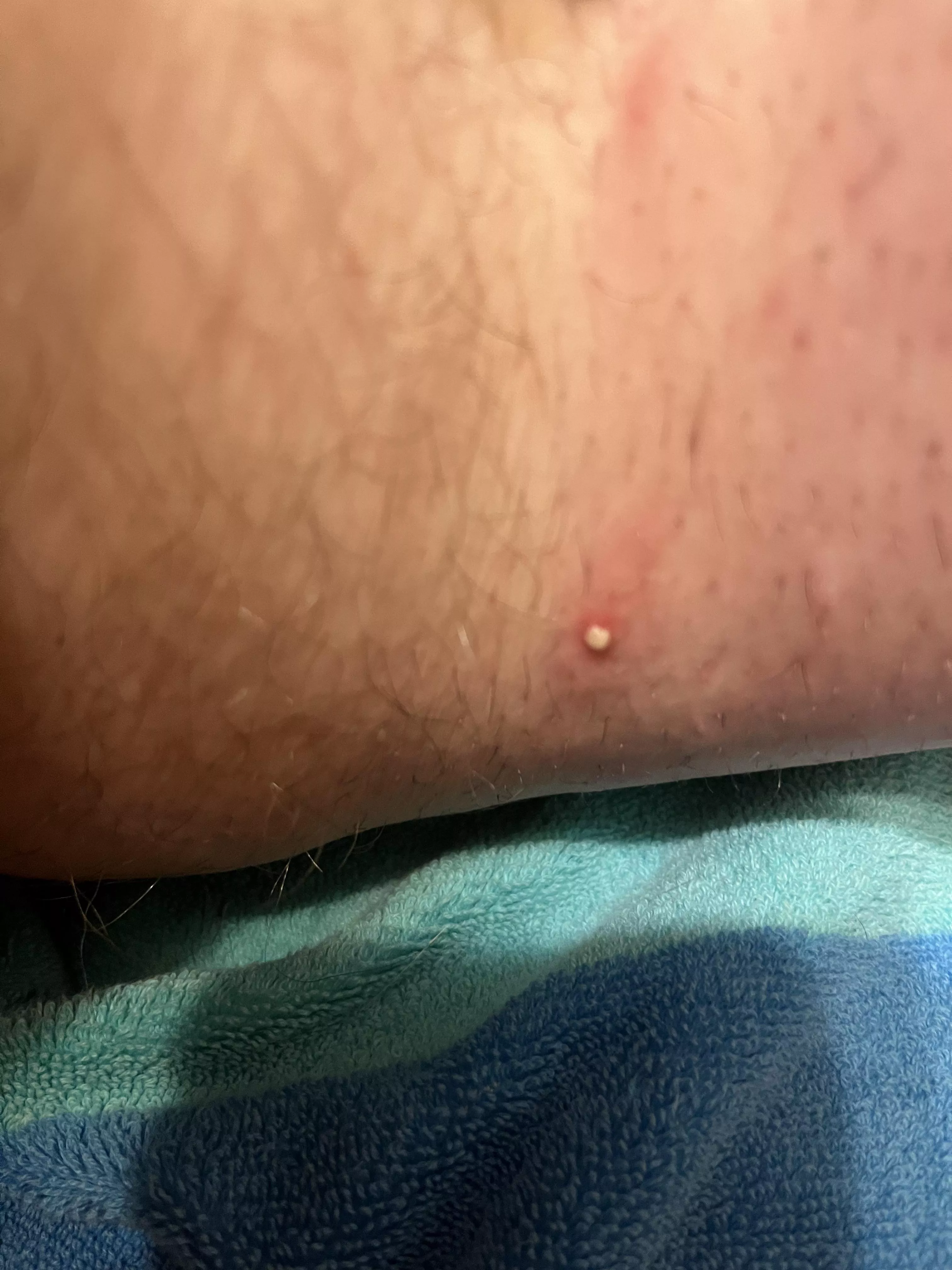 I simply can’t believe it hadn’t already popped! posted by PPHillips