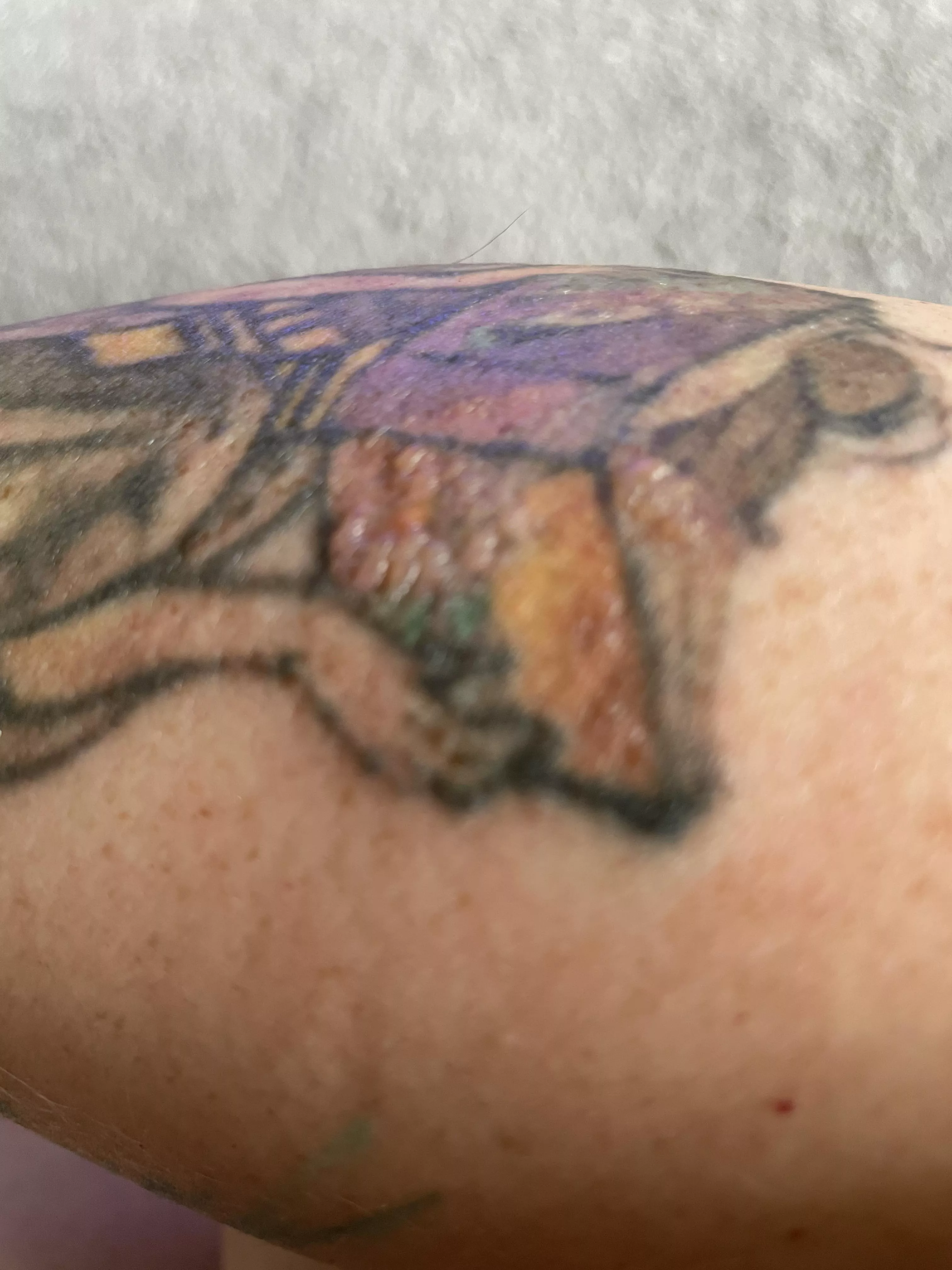 I’m getting a tattoo removed and had a treatment yesterday. Left some nice forbidden pops on the colored sections today. posted by TheSewseress