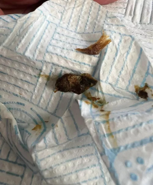 My husbands ears are disgusting lmao he almost threw up at this by jessical1998