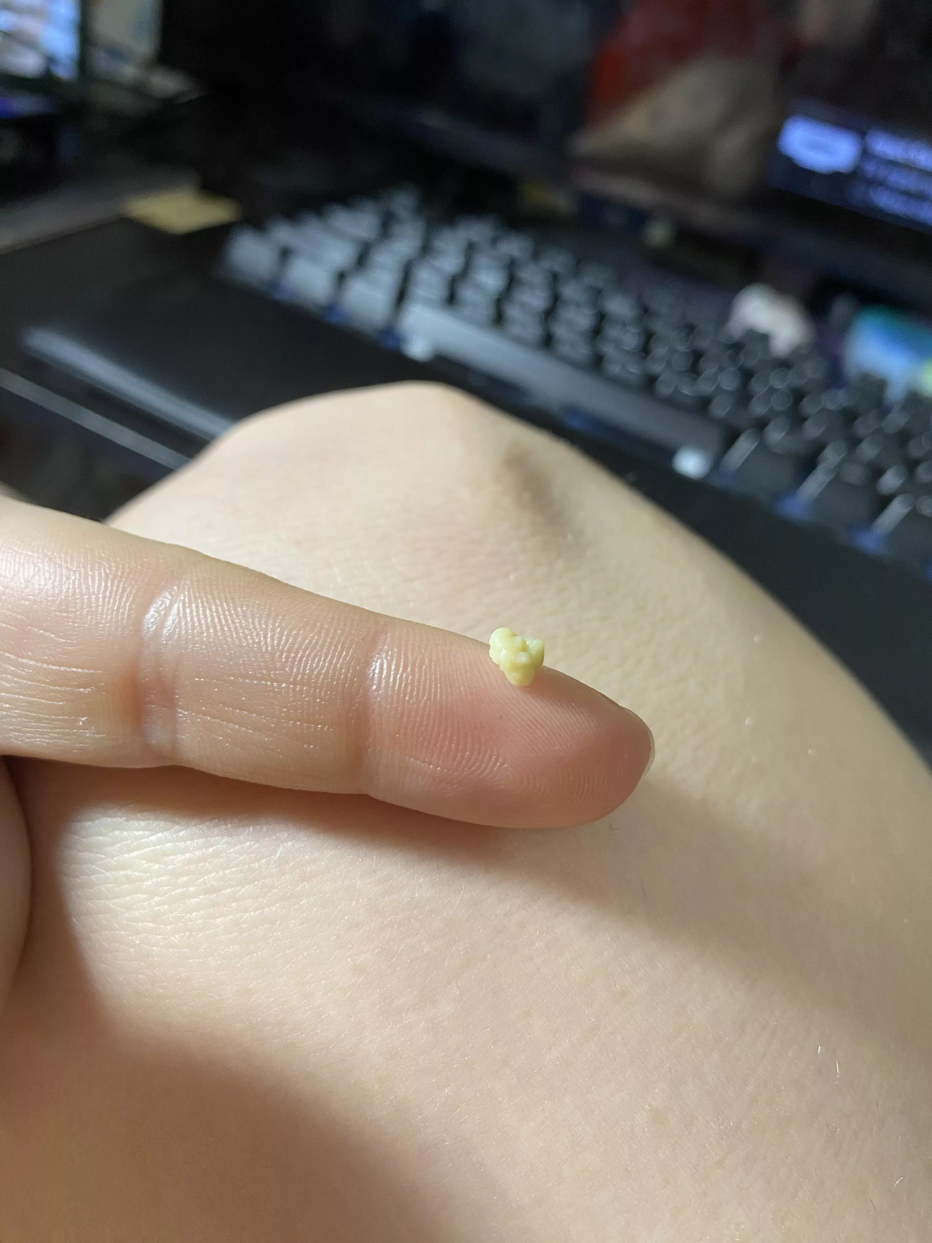 No wonder my throat hurt… I can feel more back there. posted by Three-Skin-