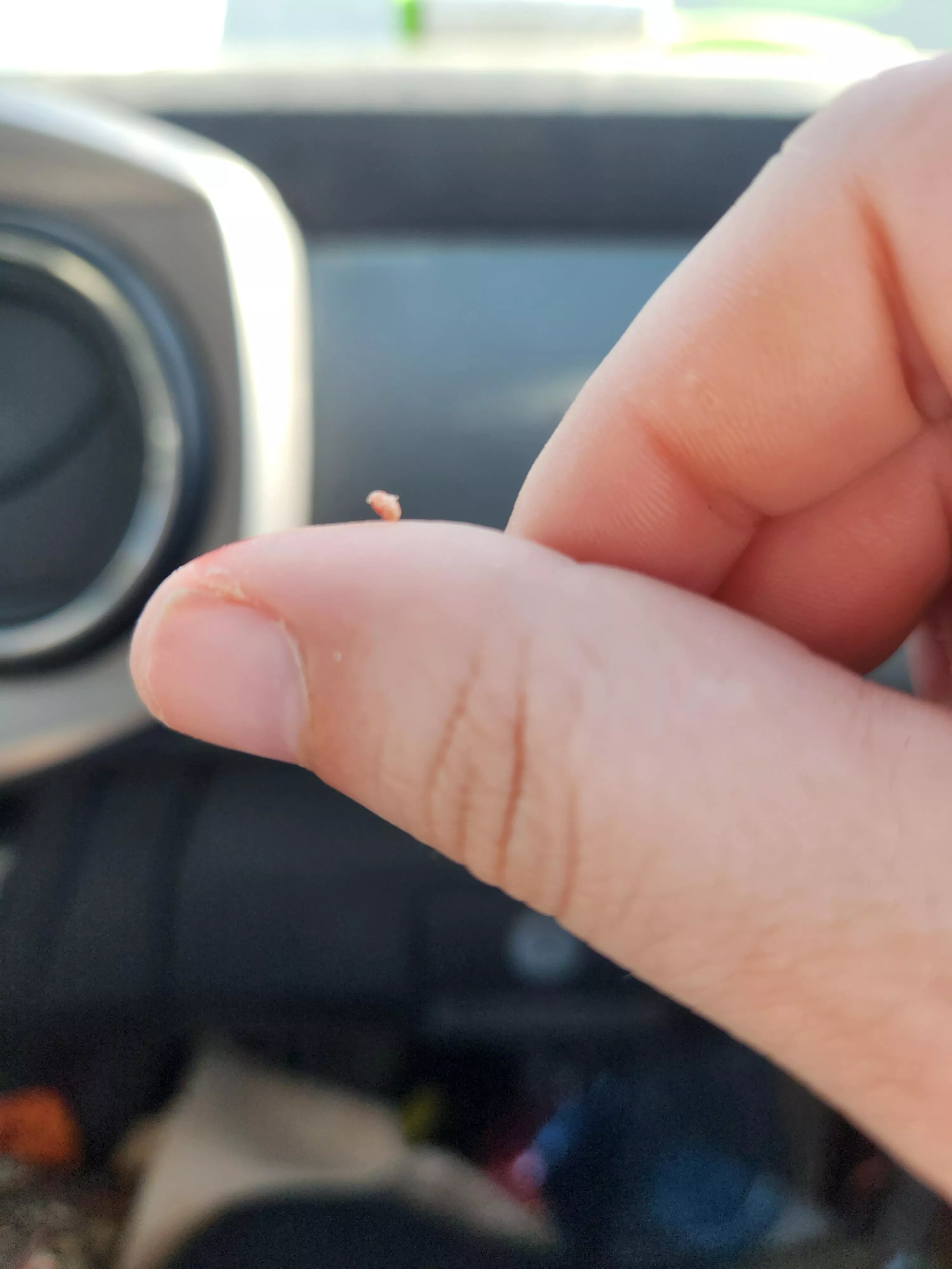 Finay defeated my month long pimple posted by ashleycotov