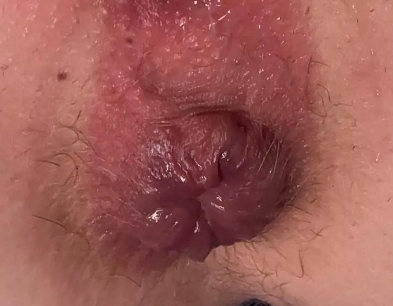 My pumped up asshole posted by StrawberrySugarPie