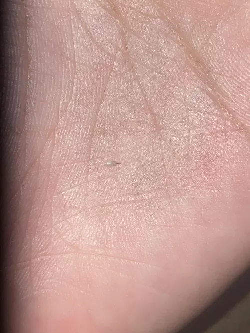 Popped this out of my ass and it’s recurring what exactly is it? There’s always hair in this bead? by Boredom_fighter12