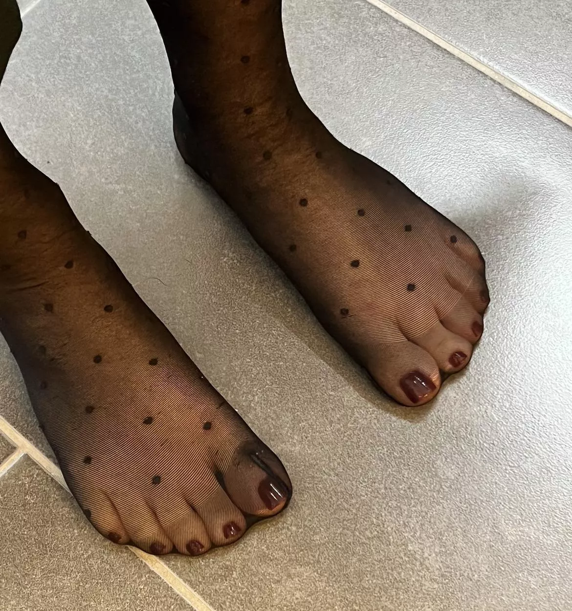 With or without my topstockings? posted by Comfortable_Clock_87