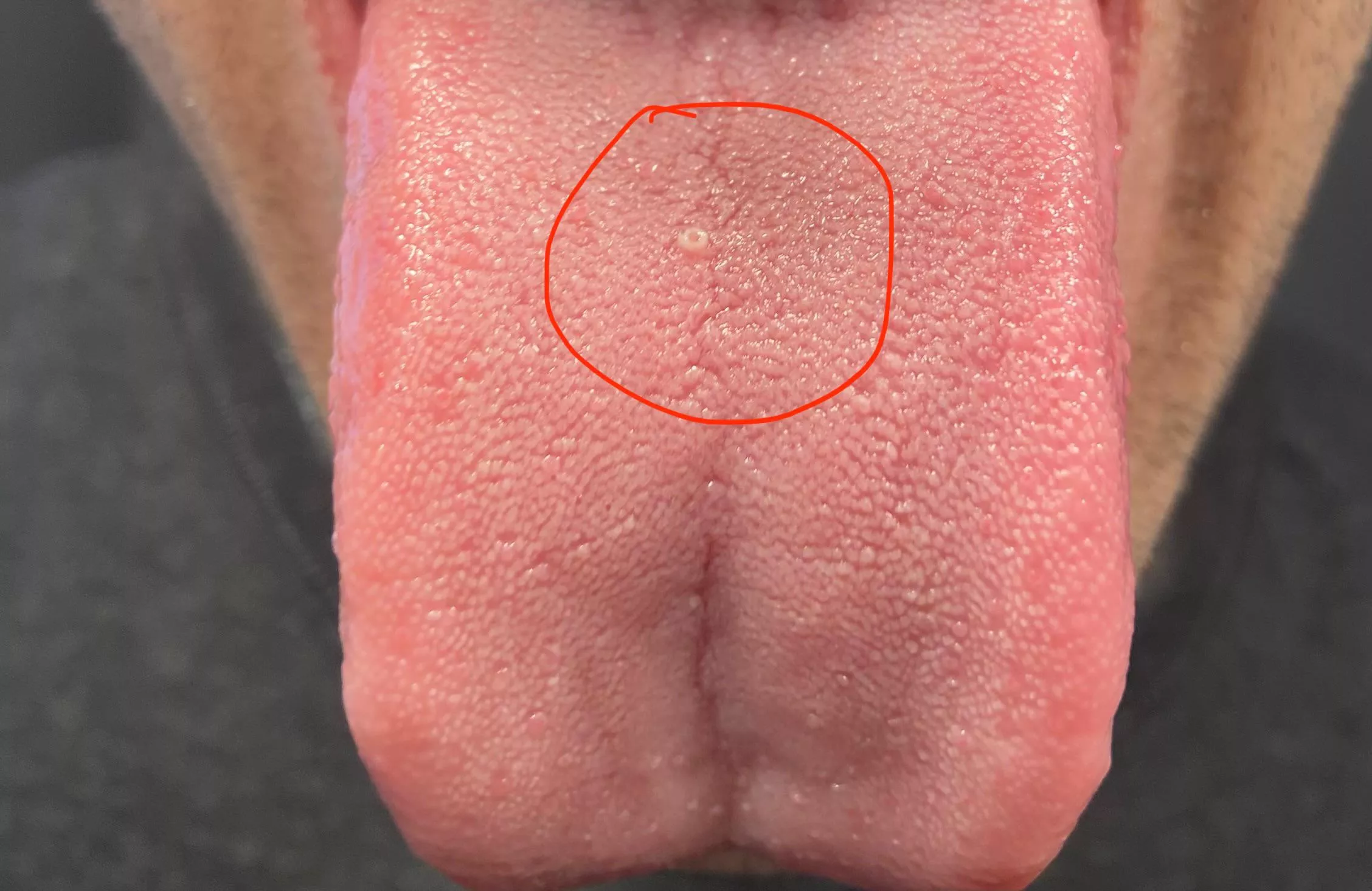 Anyone have any idea what this is? I’ve popped a couple times now. posted by Jimmychoo152