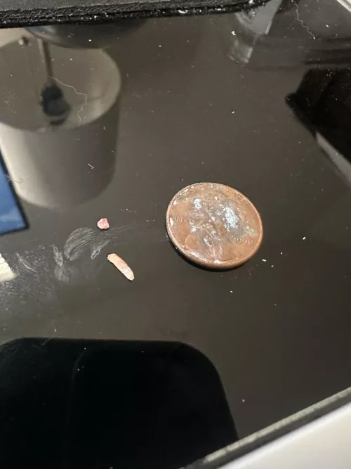 Came from my elbow area, penny for reference. Anyone knows what this is? Didn’t pop like a normal blackhead by GoodestManLukas