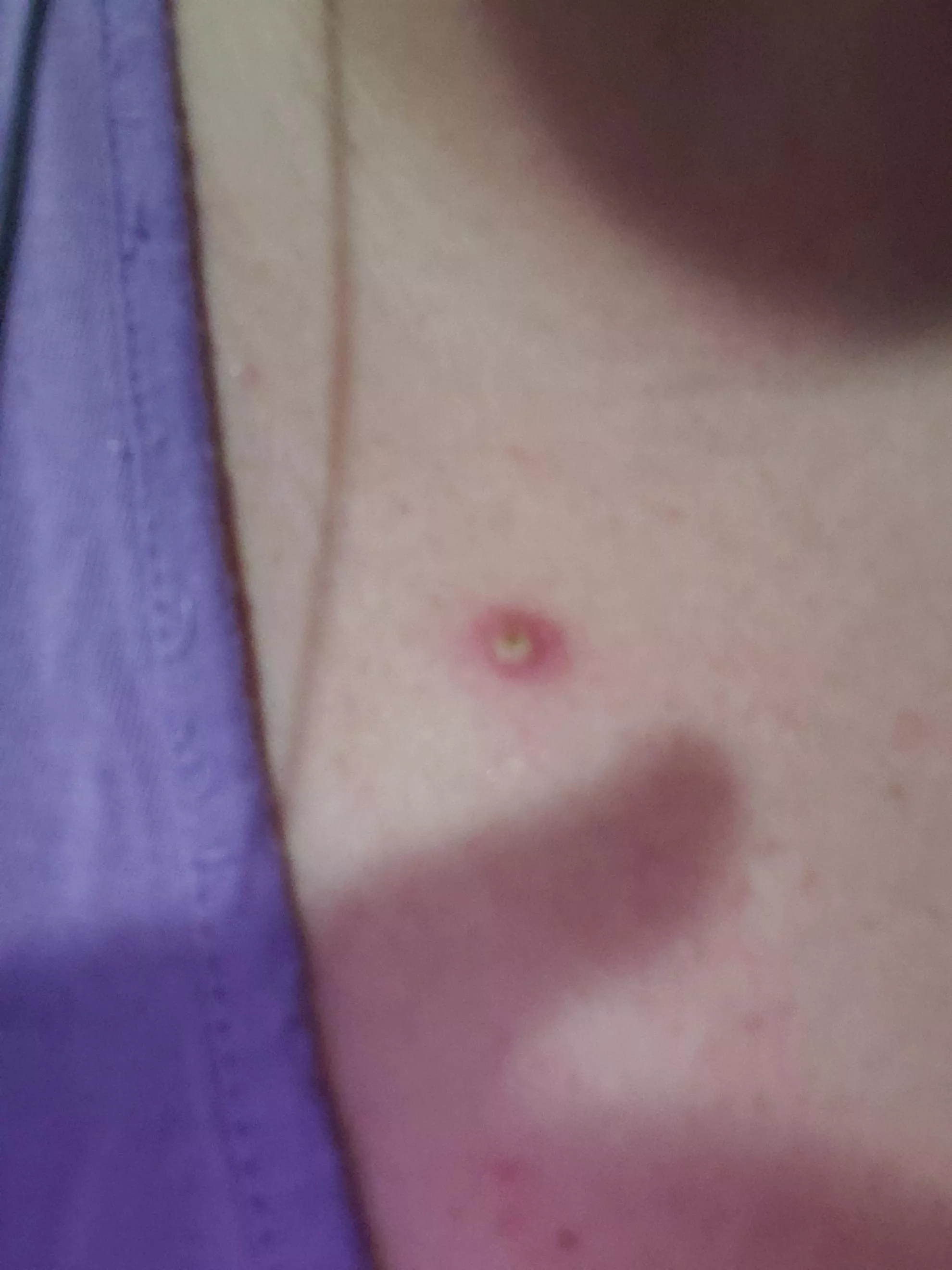 I may have to break up with my fiance She won't let me pop this monster! posted by ogpuffalugus