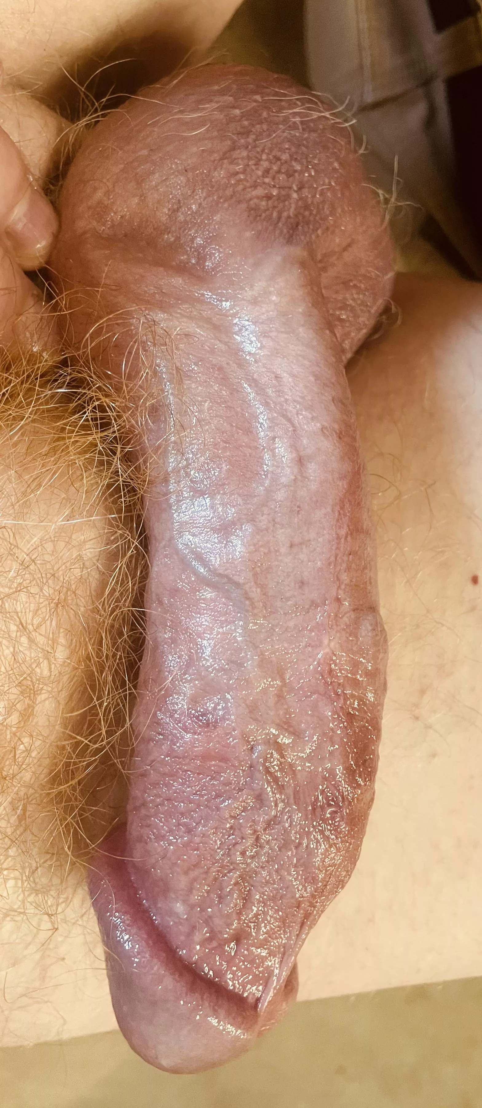 I need relief from the swelling… posted by Relevant_Junket6404