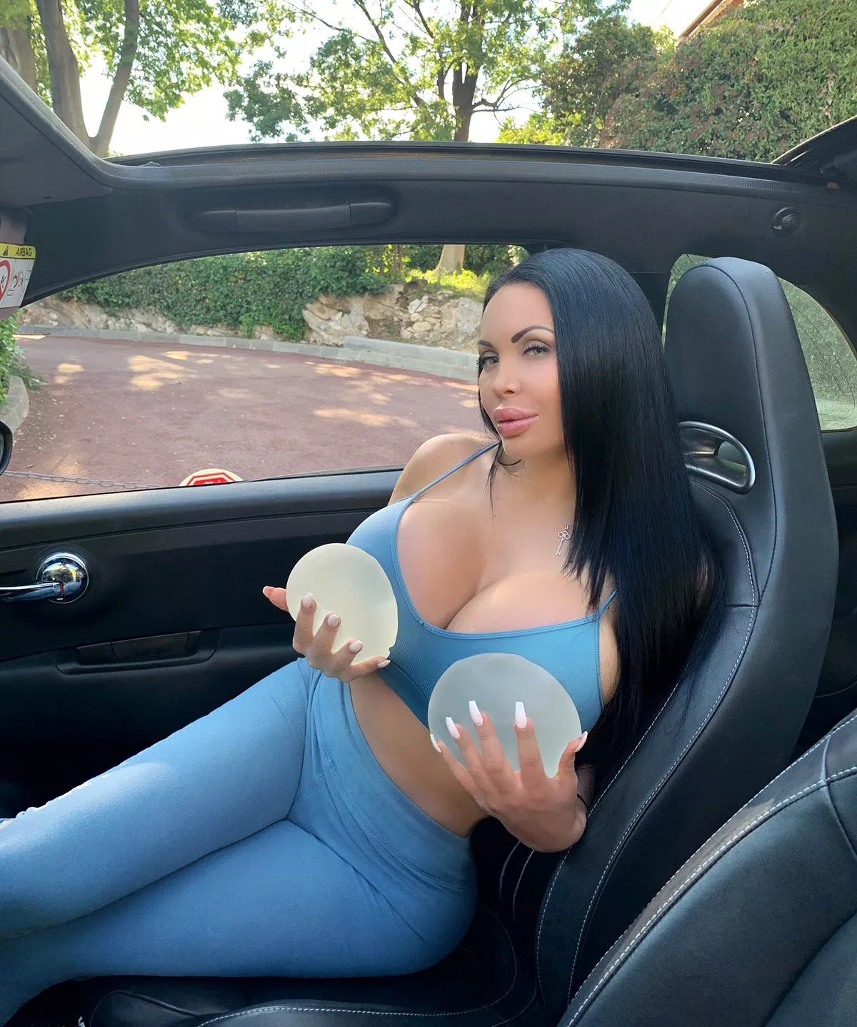 Old Implants VS New Boobs posted by Complex_Notice5680