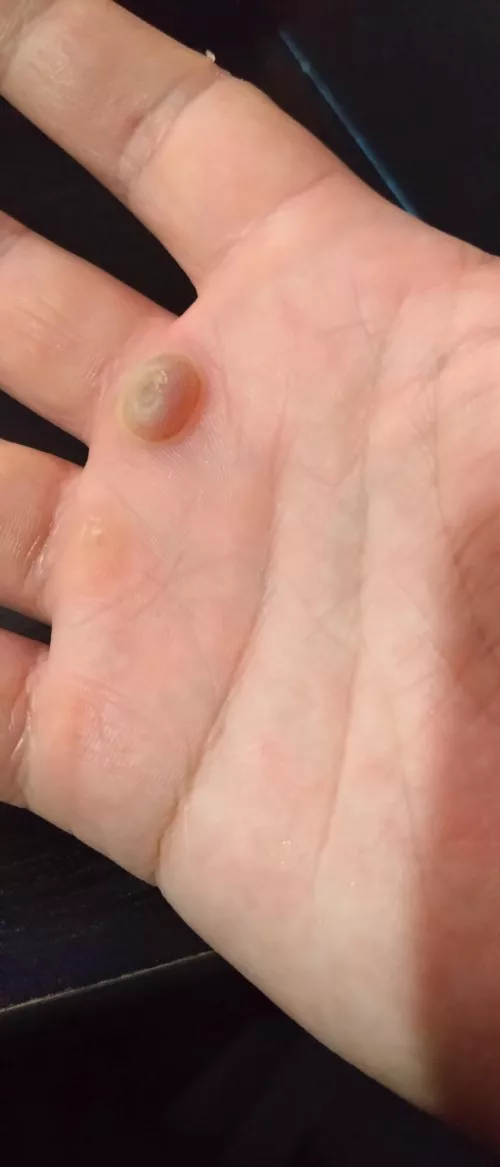 Taking all my willpower not to pop this little fucker by TunaMan92