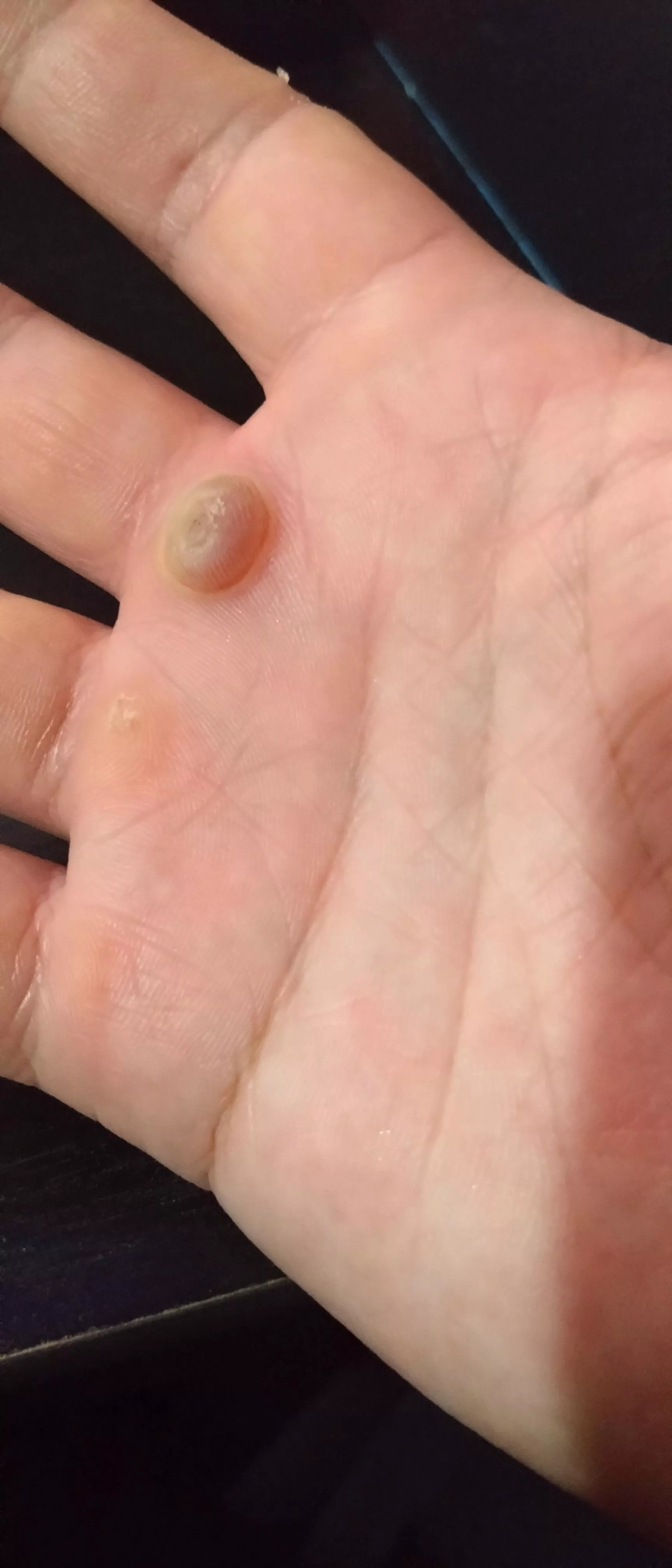 Taking all my willpower not to pop this little fucker posted by TunaMan92