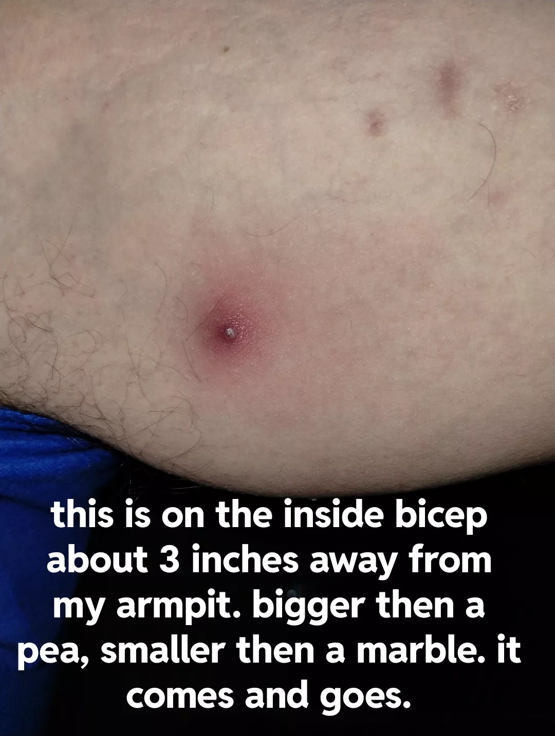 Before I pop what is this ? posted by Altruistic-Cut9795