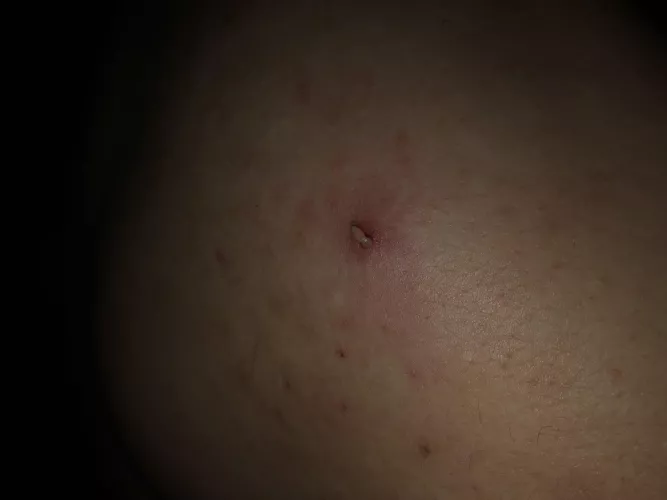 Brutal one on my shoulder 😳 by charlesebastian