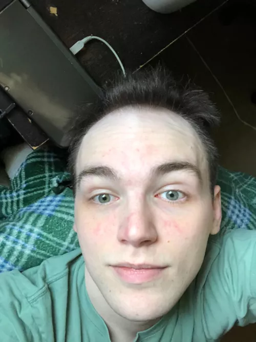 Feels so great after a shower feeling abit less good today though by Disneyfan253