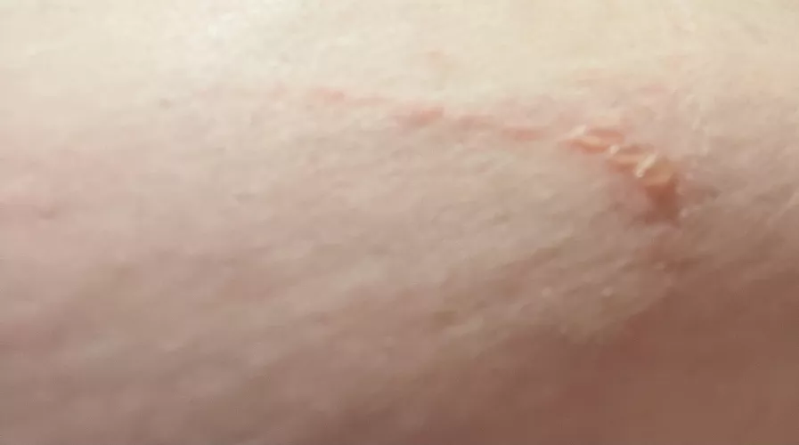 Forbidden pops from KT tape. by taiken116