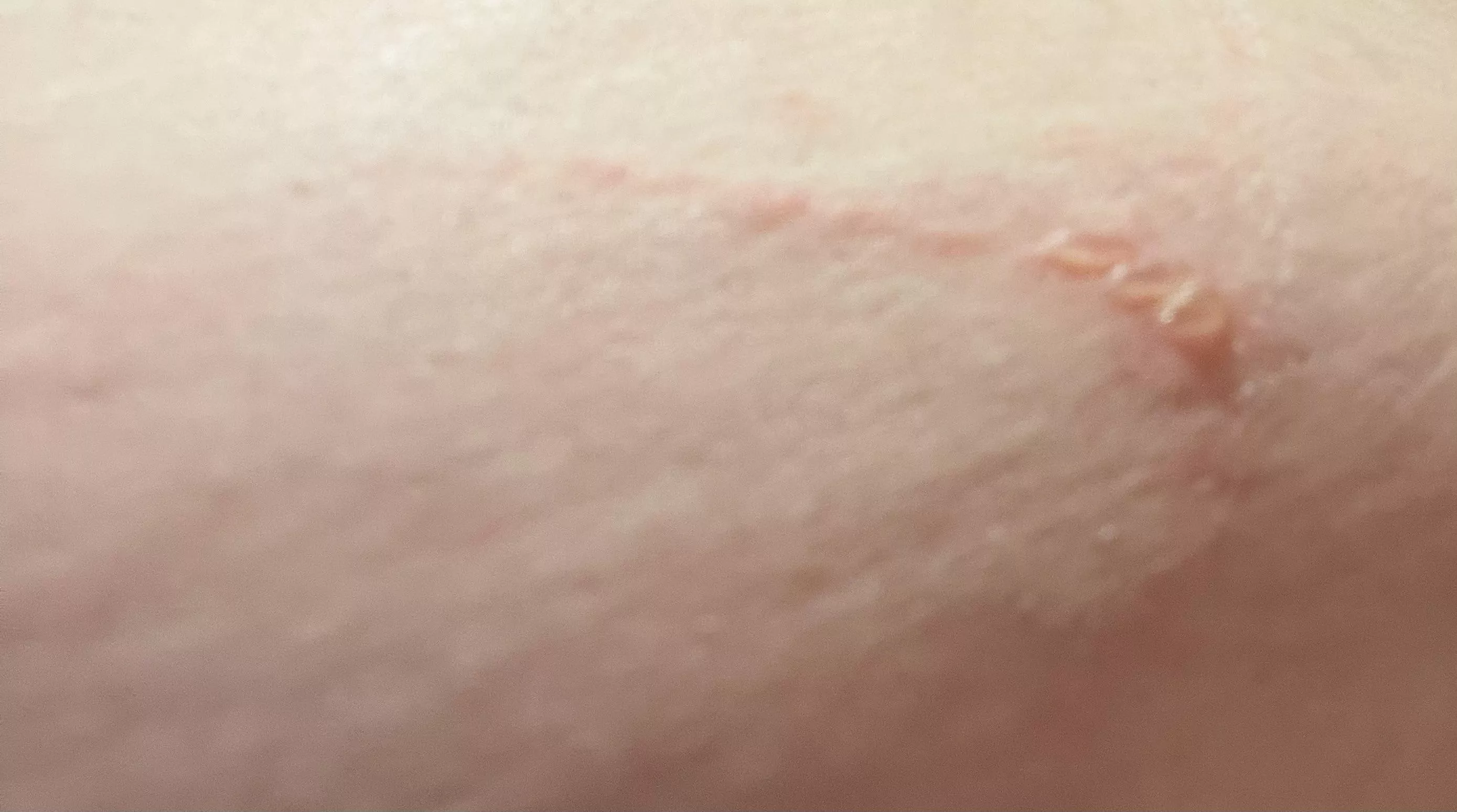 Forbidden pops from KT tape. posted by taiken116