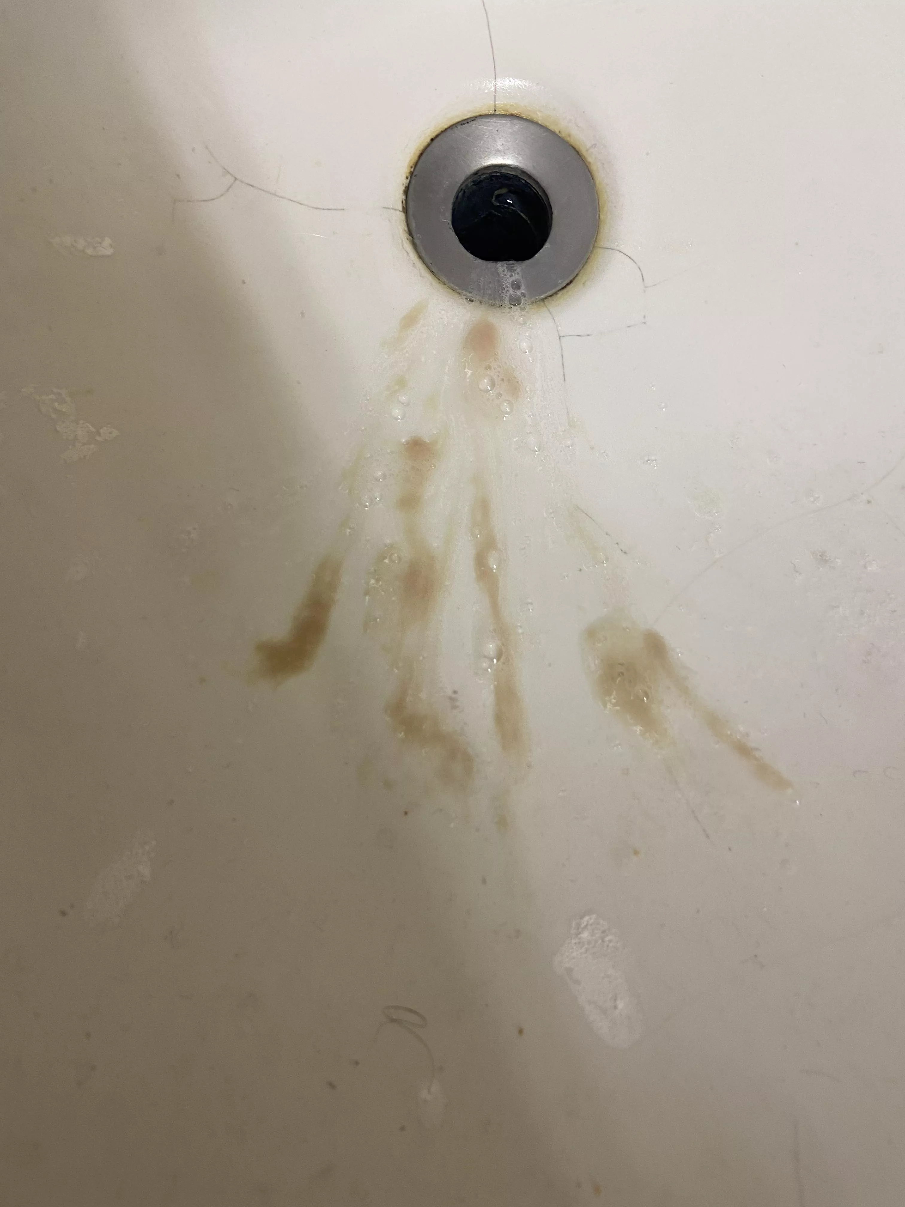 Aftermath of a tonsillar abscess. Was spitting out pus for 20 minutes posted by pedrooftomorrow