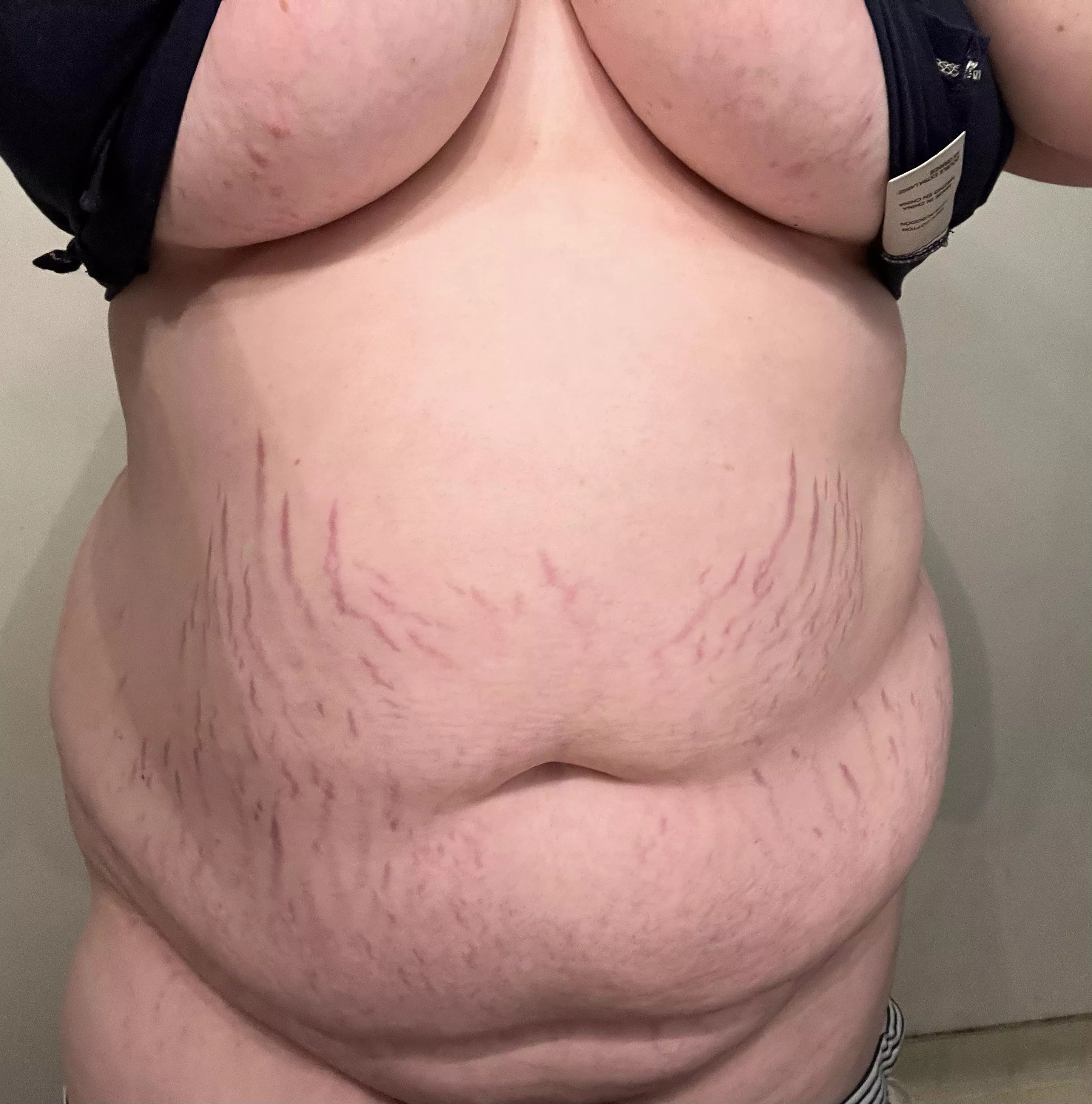 Anyone like stretch marks??? posted by Sirsluttywhore