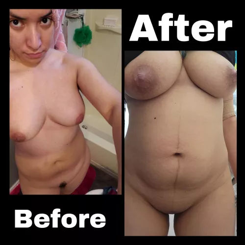 Before or after what do you chose by Glittering_Sail_1508