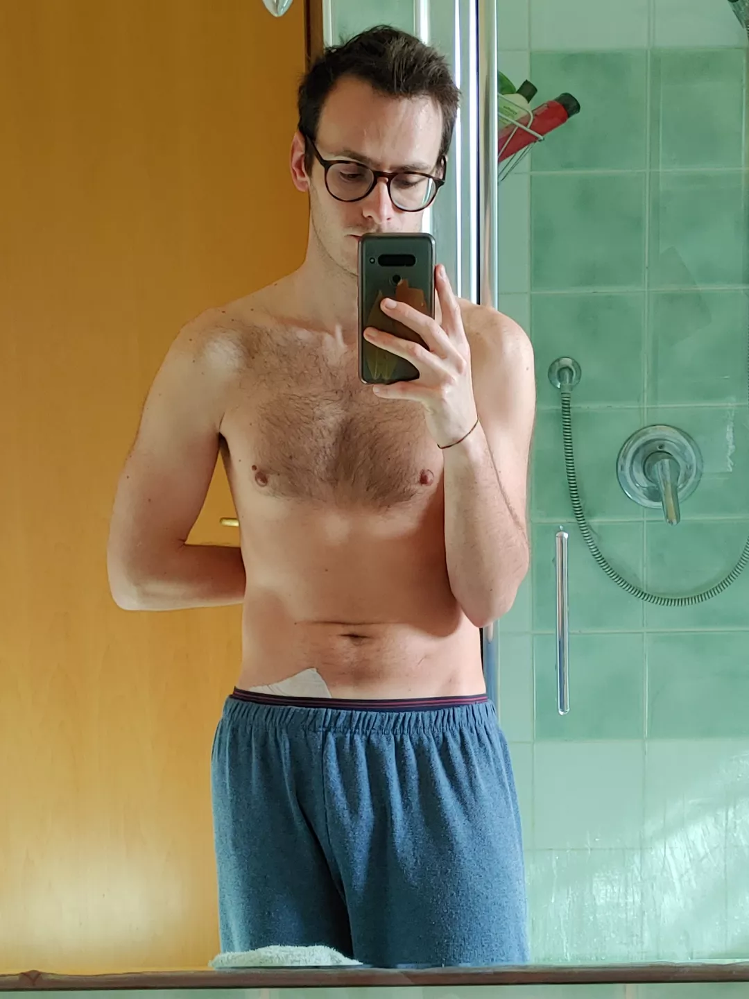 [24] Grumpy face and post-surgery plaster showing, but felt cute nonetheless so here I am, hope you guys will like the pic 🎈 posted by _fraxx