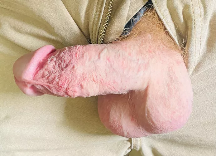 Ginger balls… by Relevant_Junket6404