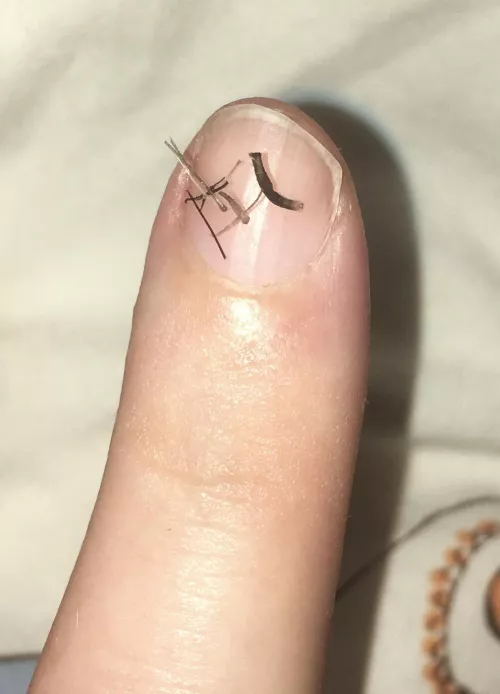 Abnormally thick beard hair. Normal sized ones are also included for reference. by SymbioticWoods