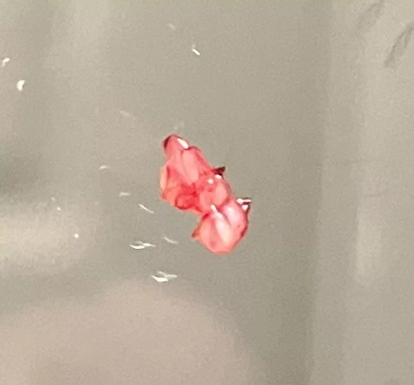 Ahhh relief, came out of “pimple” posted by Sorry_Ad9761