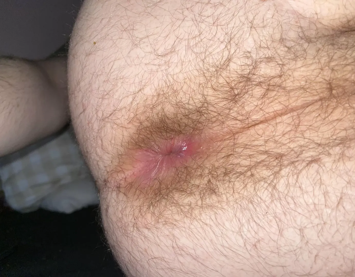 i wish i could eat my own hairy hole posted by slimeyglobe