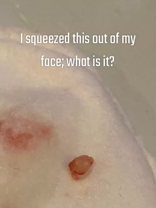I squeezed this out of my face, what is it? by Trapezius8
