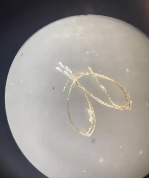 ingrown hair cluster under a microscope by mike1351